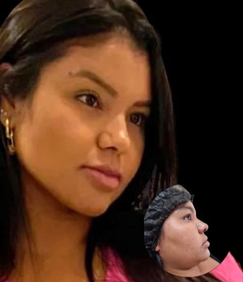 Antes e Depois 2
